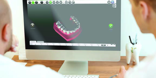 E-Aligner – Solution 3D et traitements par gouttières d’alignement