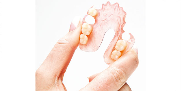 SIVP Dentaire : les prothèses Flexites réalisées en Valplast