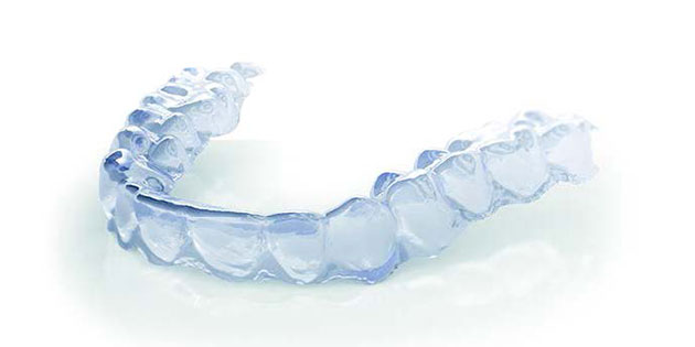 DentoSmile/Biotech Dental : des gouttières transparentes pour un traitement sur mesure