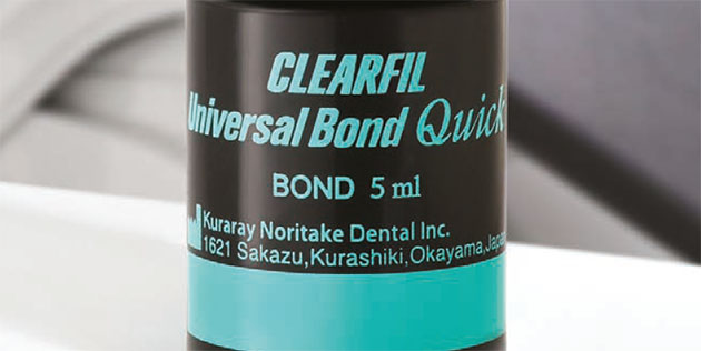 Clearfil Universal Bond Quick de Kuraray : un adhésif à action instantanée