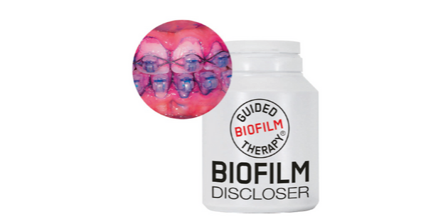 Biofilm discloser, un révélateur de plaque en deux tons