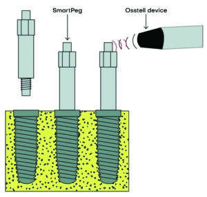 stabilité implant