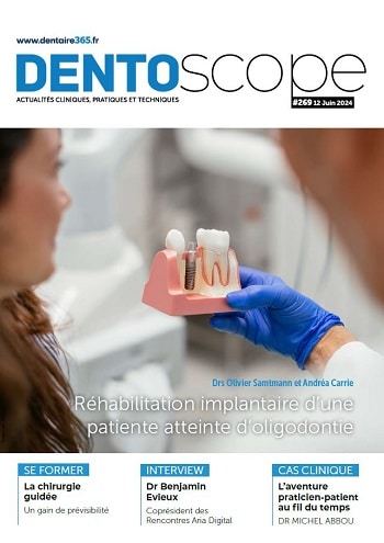 dentoscope269