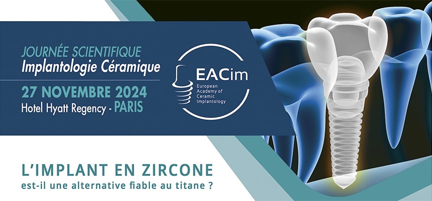 Séminaire EACim à Paris : Apprenez à prévenir la péri-implantite