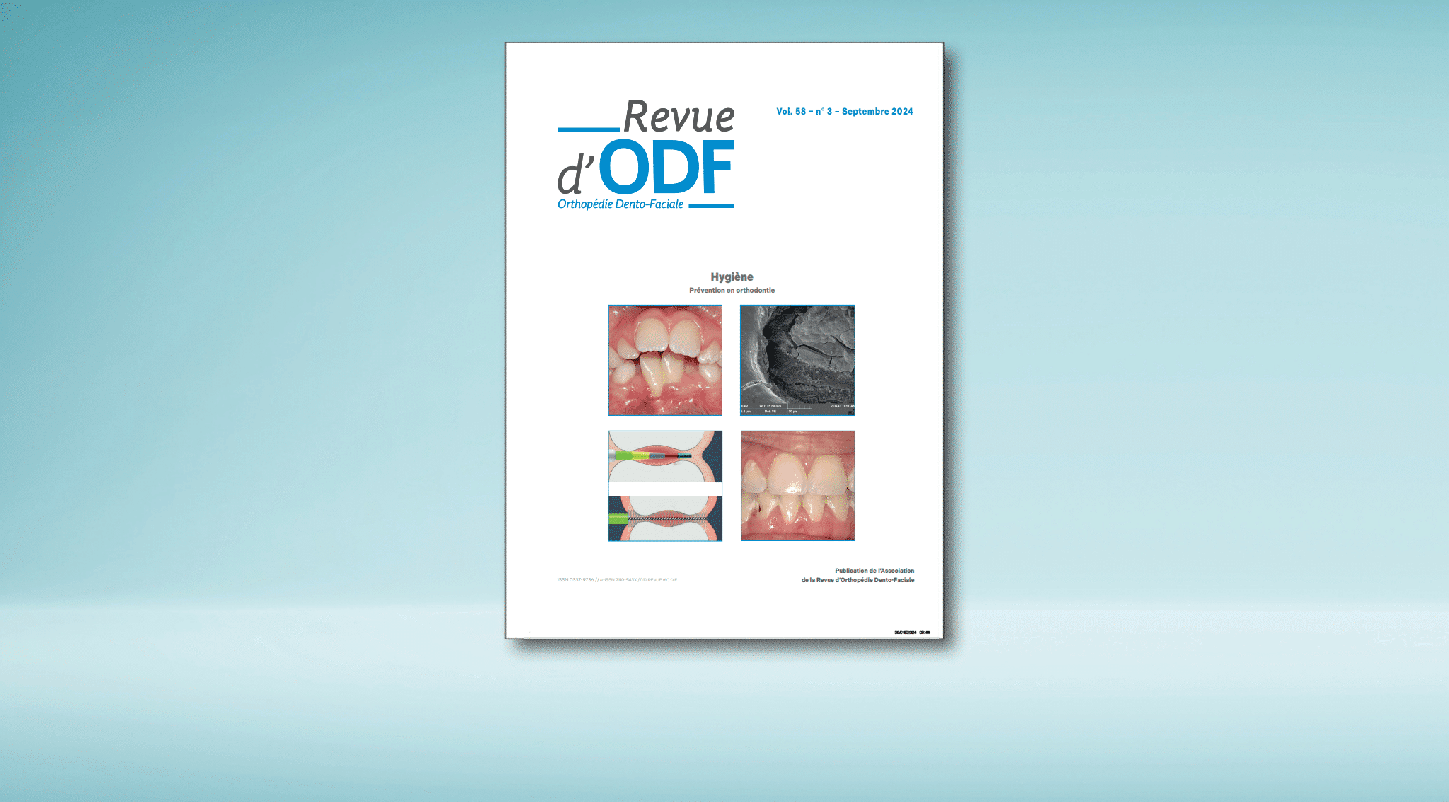 La Revue d’ODF – N°58-3 : Hygiène, prévention en orthodontie