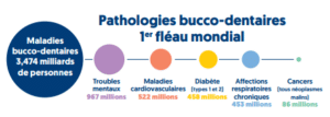 maladies bucco dentaires monde ufsbd