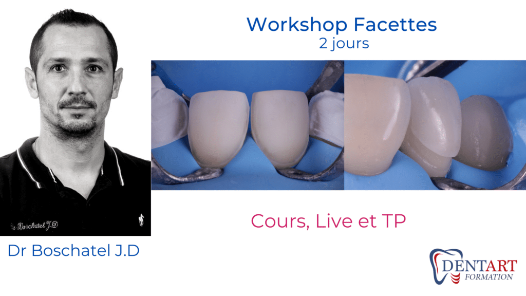 workshop facette live ok