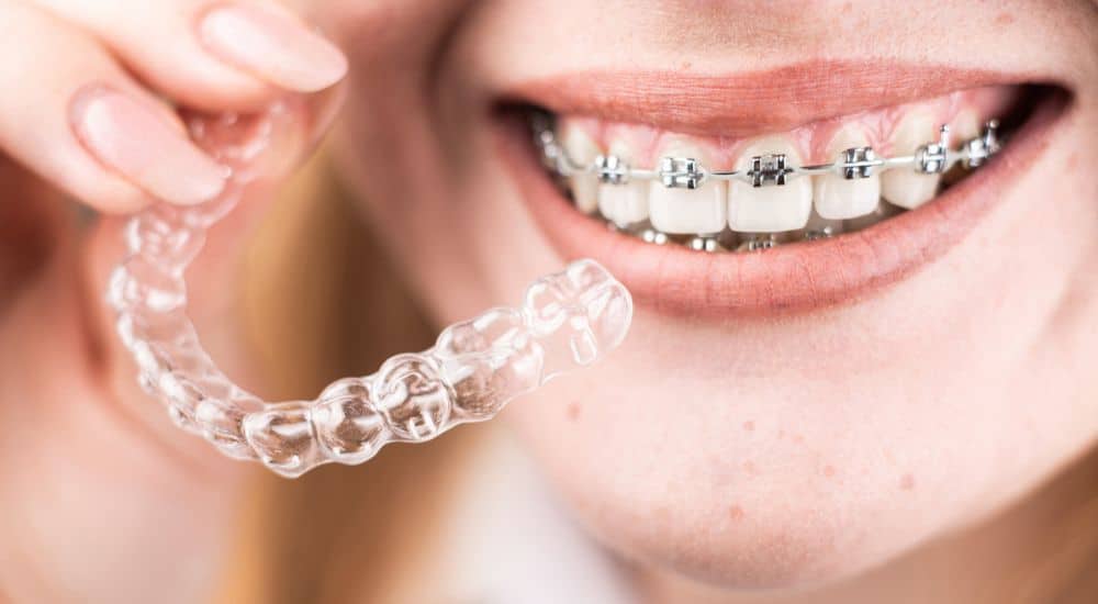 Une fille souriante avec des appareils orthodontiques sur les dents tient des gouttières dans ses mains, Traitement orthodontique