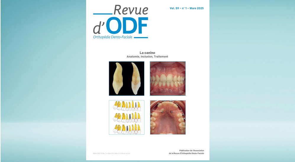 La Revue d’ODF – N°58-4 : La Canine: Anatomie, Inclusion, Traitement